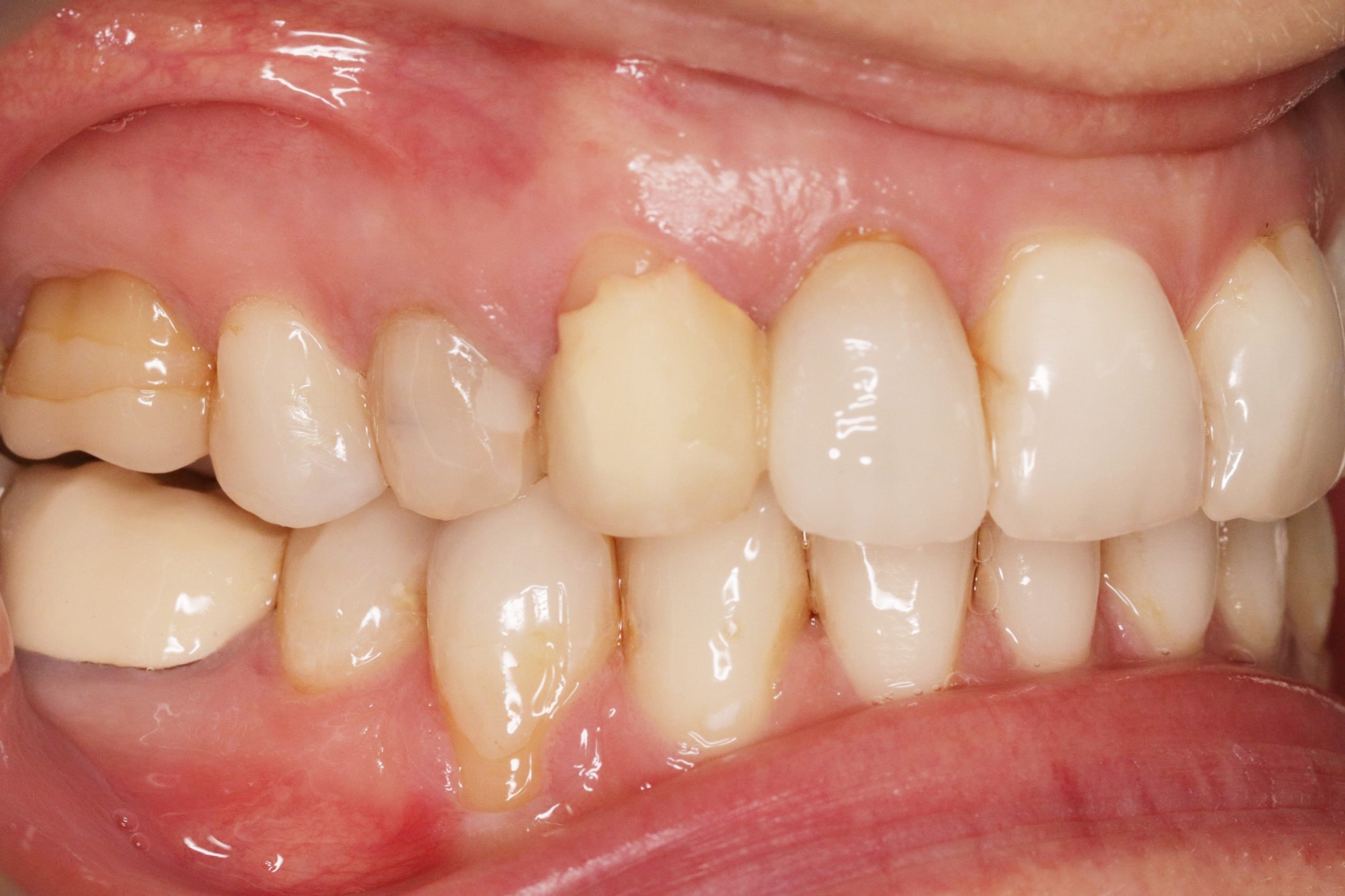 Before image