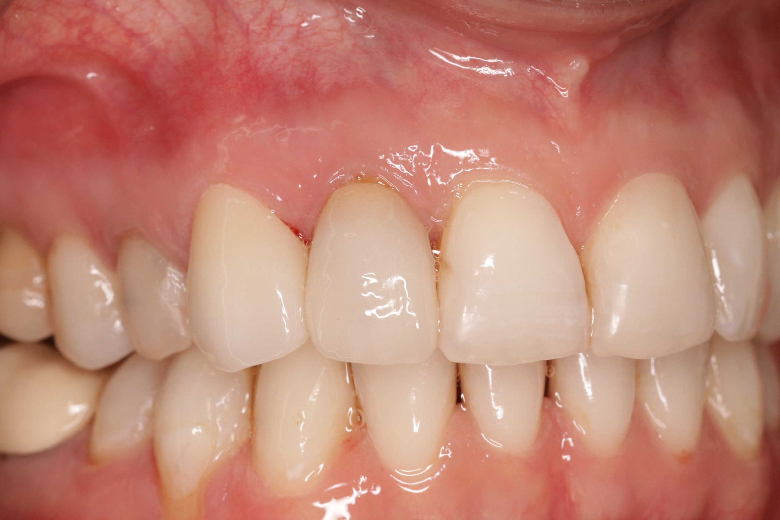 After image